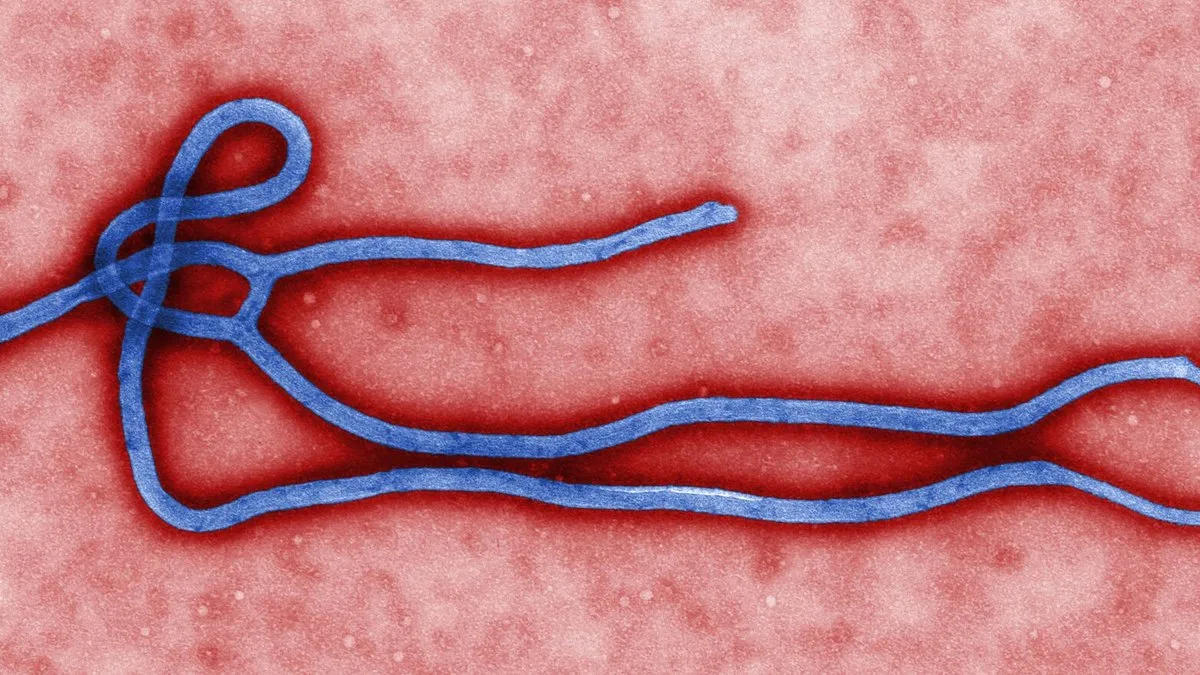 Coloured electron micrograph of a filamentous Ebola virus particle