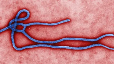 Coloured electron micrograph of a filamentous Ebola virus particle